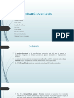 Pericardiocentesis - Tecnica QX
