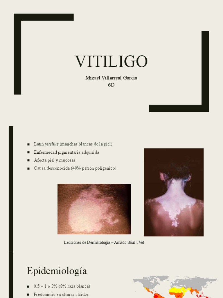 Vitiligo | PDF | Dermatología | Especialidades Medicas