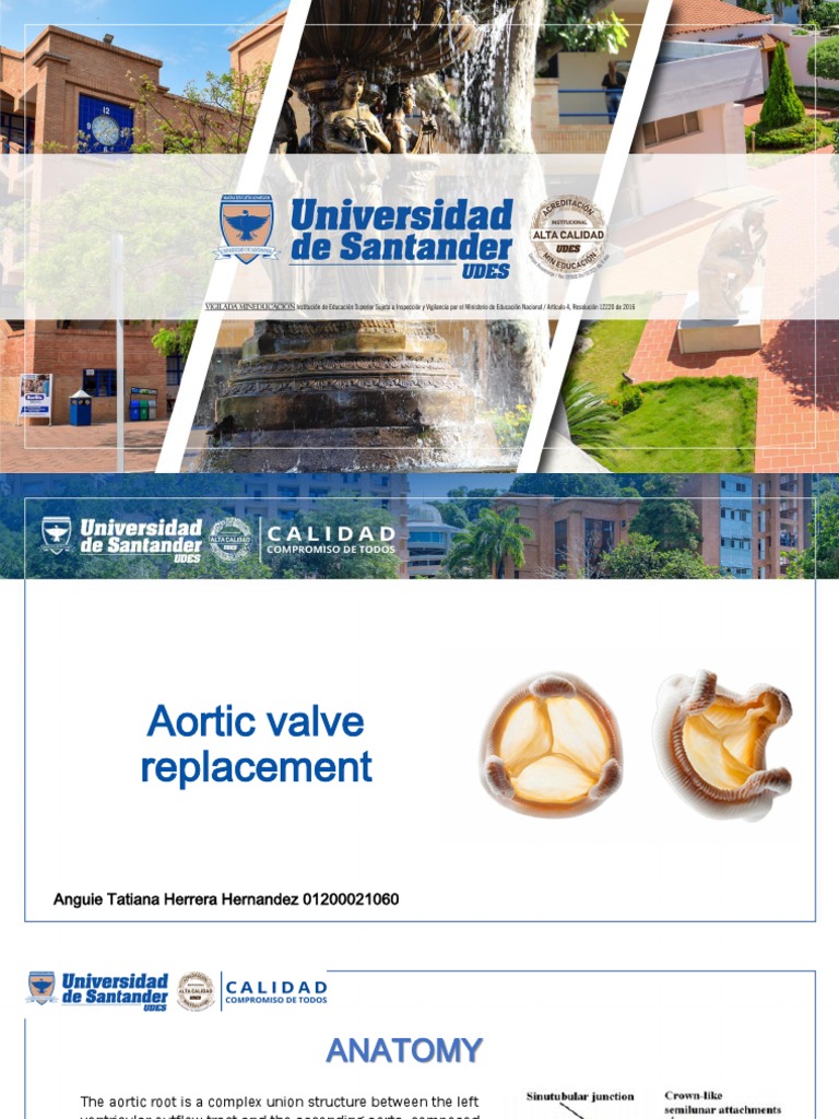 Caso Clinico de Reemplazo Valvular Aortico PDF