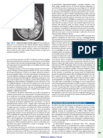 SIDA - Síndrome de inmunodeficiencia adquirida 4