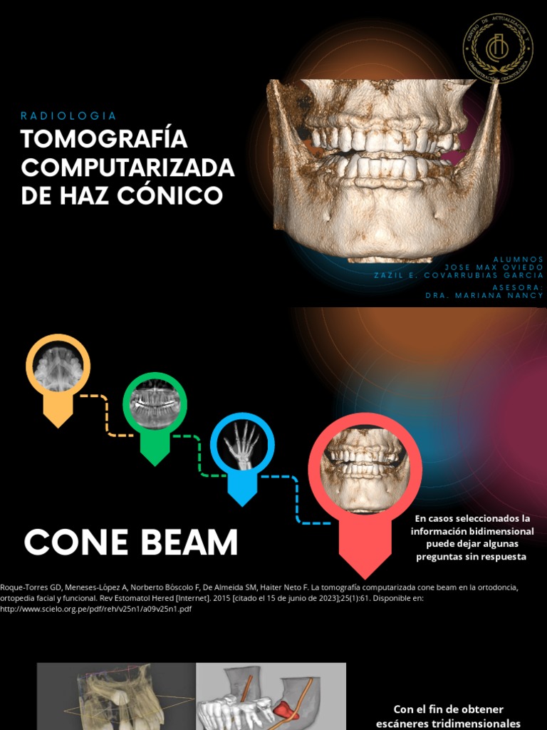 Tomografía Cone Beam en Odontología | PDF | Ct Scan | Especialidades ...