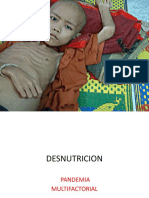 Desnutricion 16