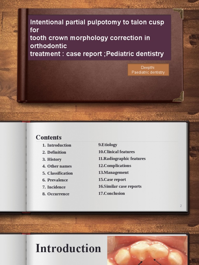 Partial Pulpotomy for Talon Cusp Correction | PDF