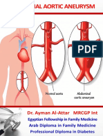 Abdominal Aortic Aneurysm