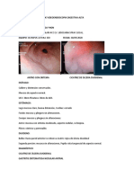 Informe de Videoendoscopia Digestiva Orrillo Estrada