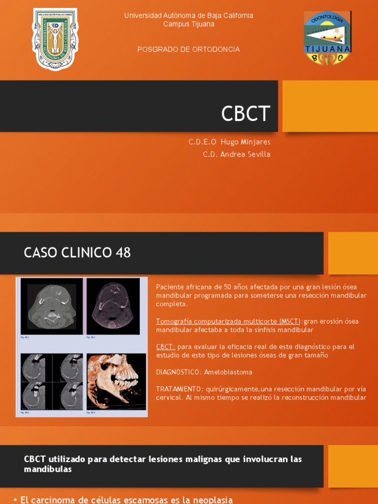 Aplicaciones de CBCT en Ortodoncia | PDF | Ortodoncia | Odontología
