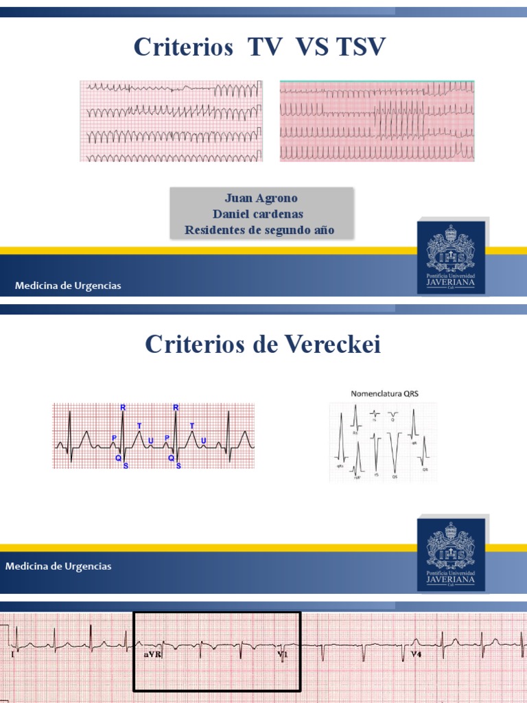 Criterios de Vereckei | PDF