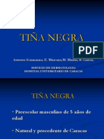 Tiña Negra