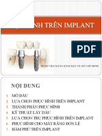 PH C Hình Trên Implant 7-2017