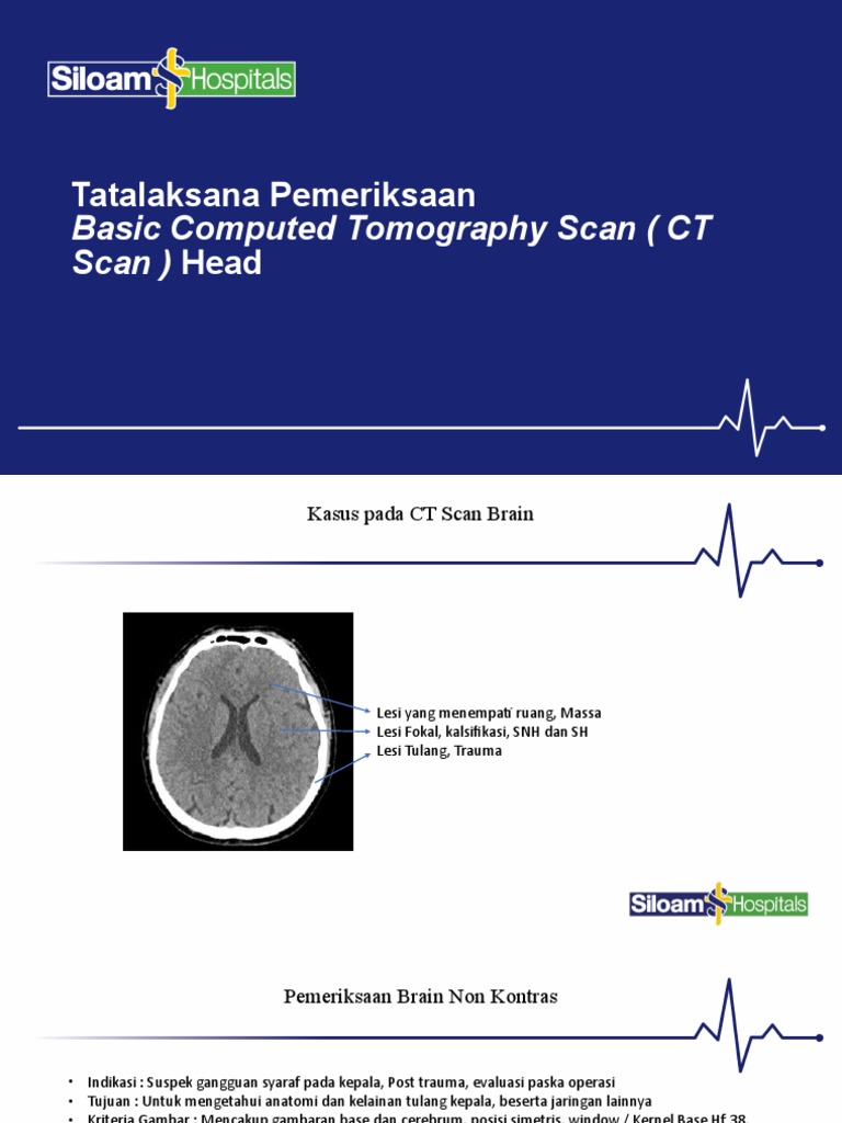 Protokol CT Scan Kepala dan Sinus | PDF | Sains & Matematika | Komputer