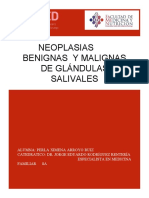 Neoplasias Benignas y Malignas de Glándulas Salivales