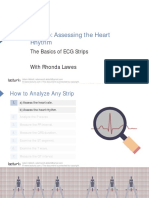 Slides Step 1b Assessing The Heart Rhythm Nursing