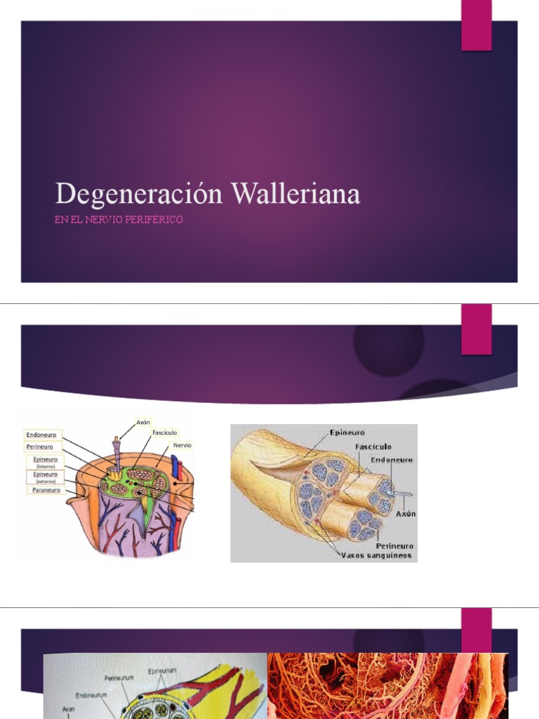 Degeneración Walleriana y Regeneración Nerviosa | PDF