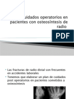 Cuidados Operatorios en Pacientes Con Osteosíntesis de Radio