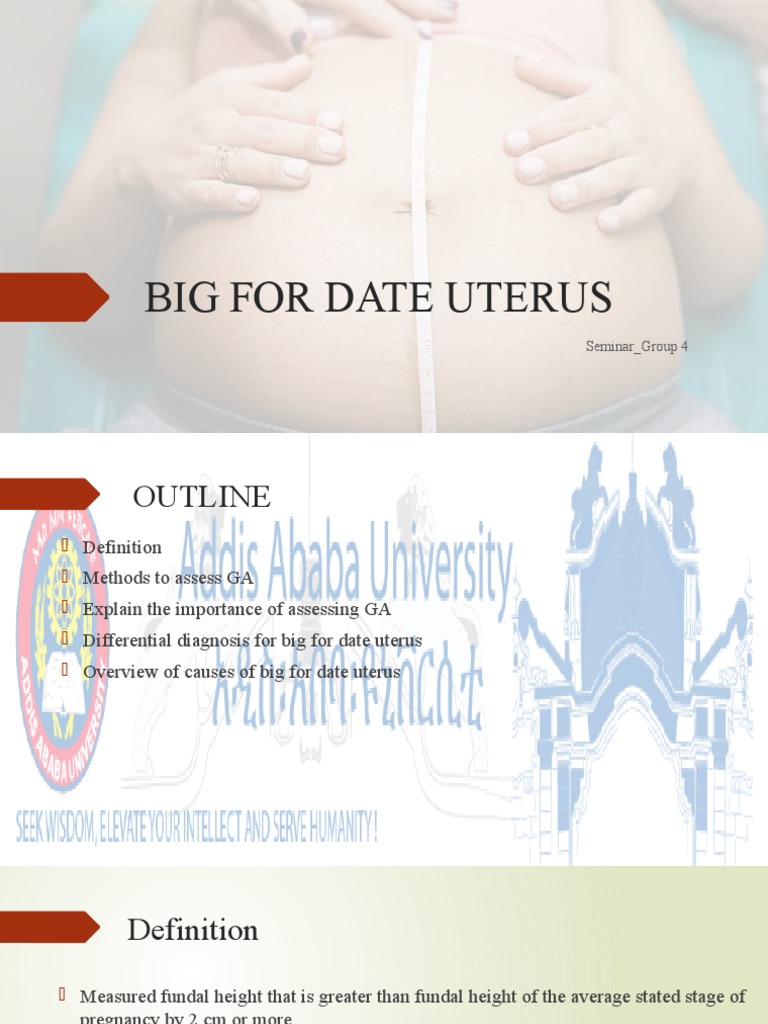 Big For Date Uterus Seminar PDF Pregnancy Childbirth