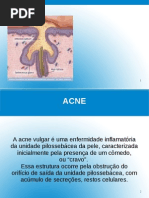 Download Acne by Aline Maria S Nascimento SN66679623 doc pdf