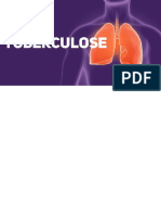 Tuberculose