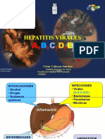 HEPATITIS Virales y Crónicas