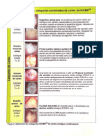 Tabla ICDAS