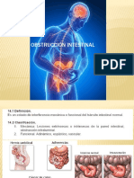 Obstrucción Intestinal