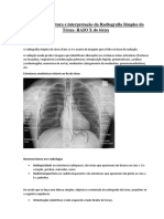 Bases para Leitura e Interpretação Da Radiografia Simples Do Tórax