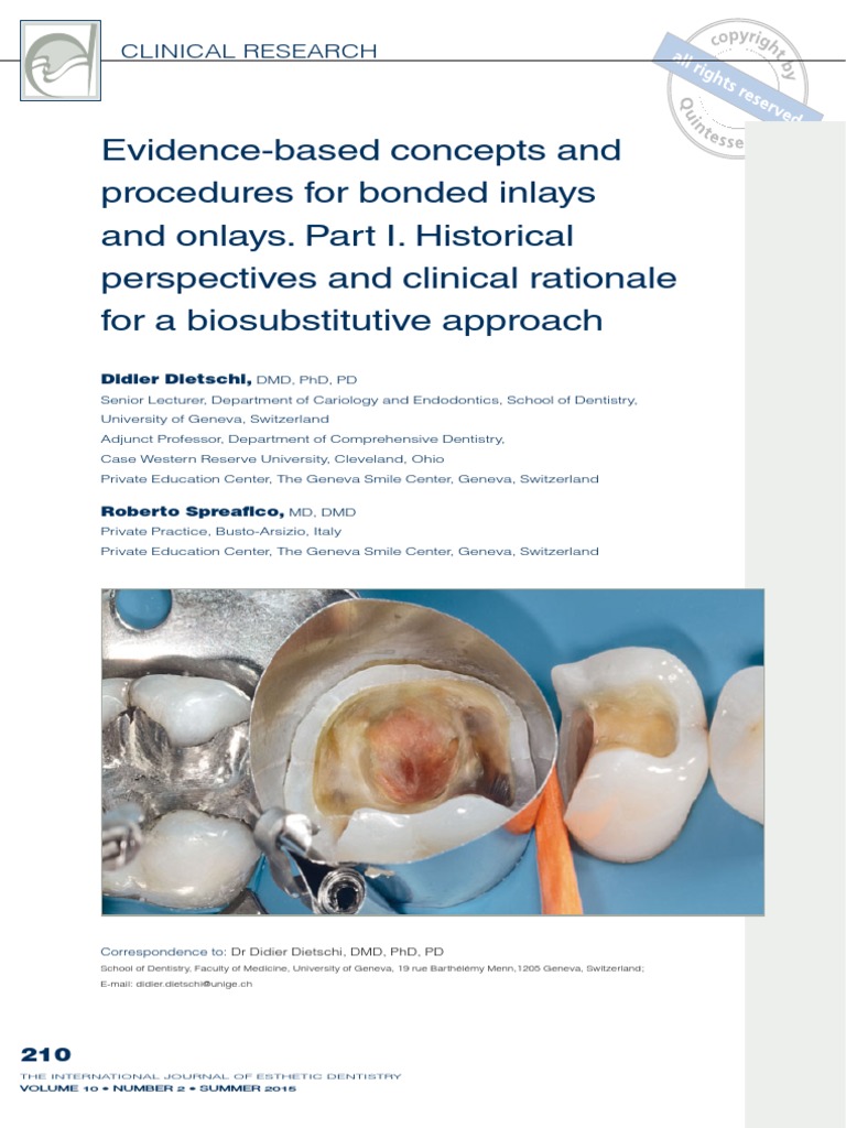 Inlays Onlays 1 | PDF | Dentistry Branches