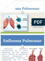 Enfisema Pulmonar