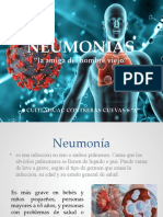 Neumonias 020556