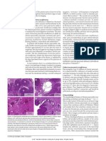 Pancreatitis 1