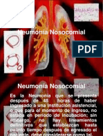 Infecion Neumonia Nosocomial