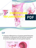 Enfermedad Inflamatoria Pélvica