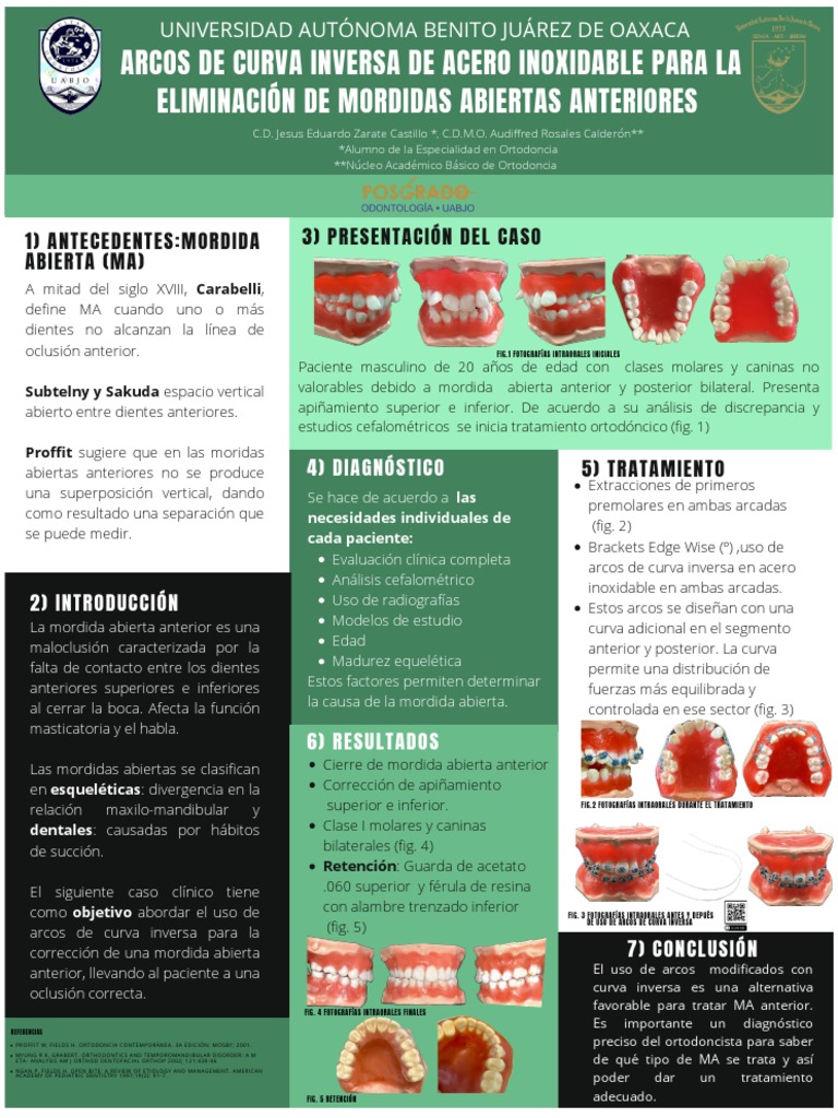 Arcos de curva inversa para eliminar mordidas abiertas anteriores | PDF ...