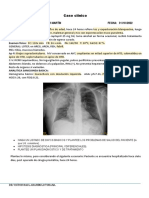 Caso Clinico