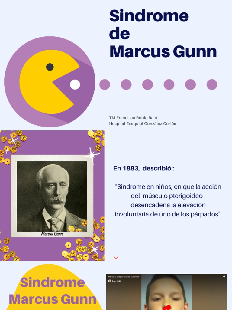 Síndrome de Marcus Gunn: Causas y Síntomas | PDF | Enfermedades y ...