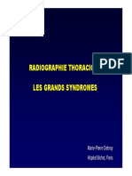 RX Thorax Grands Syndromes