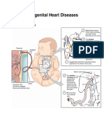 Congenital Heart Disease