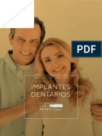 Ebook Implantes