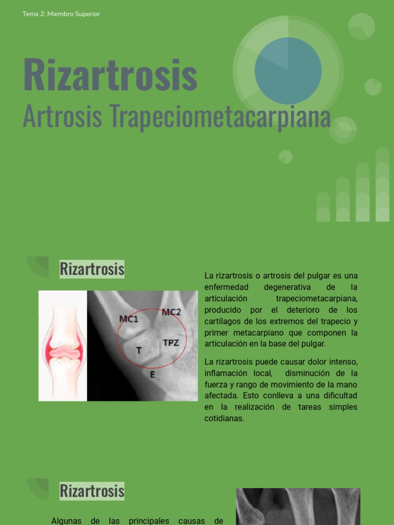 Rizartrosis: Diagnóstico y Tratamiento | PDF | Medicina CLINICA ...
