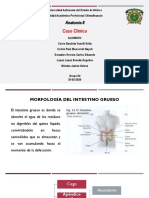 Caso Clinico Diverticulosis