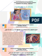 Niveles de Prevencion Tuberculosis Pulmonar