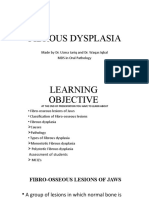 Fibrous Dysplasia 29.8.2023
