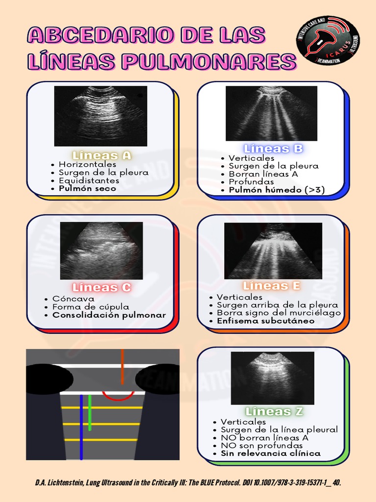 Líneas A y B en Ecografía Pulmonar | PDF