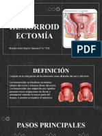 Hemorroidectomía