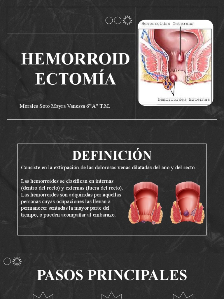 Hemorroidectomía PDF Hemorroides Cirujano