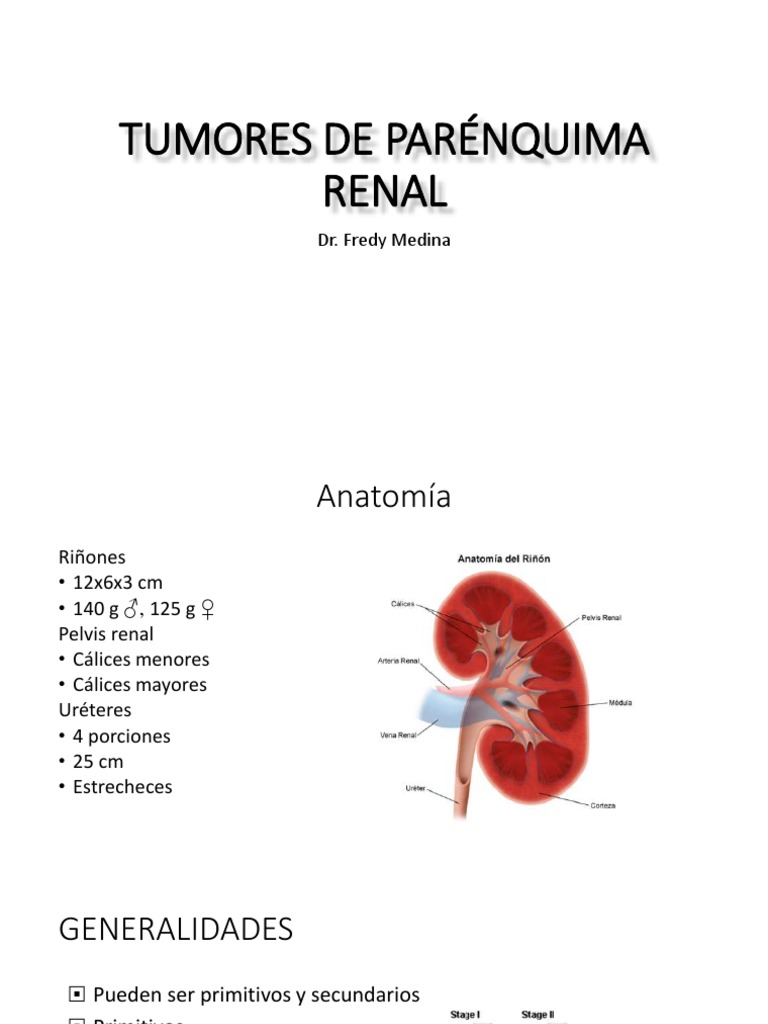 Tumores Malignos Del Riñón y Vías Urinarias | PDF | Riñón | Metástasis