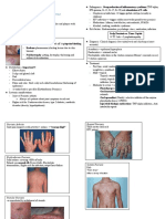 Papulosquamous