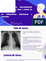 Lectura de Tele de Torax y Lateral de Torax. Sindromes Radiograficos Pulmonares y Pleurales