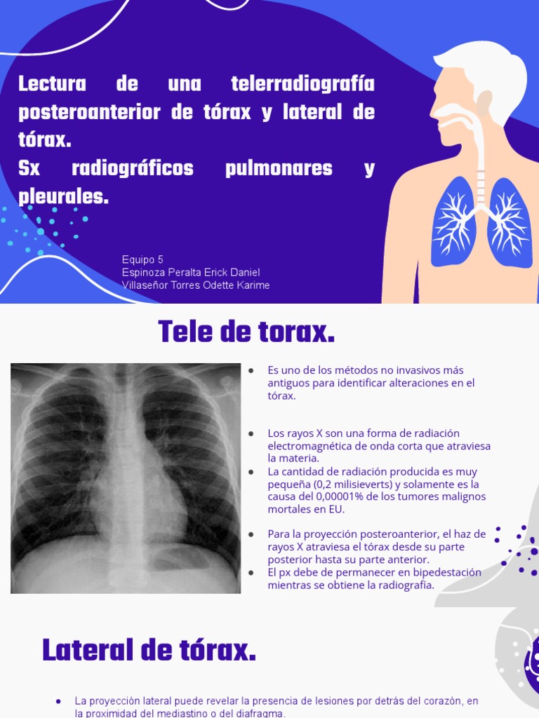 Lectura de Tele de Torax y Lateral de Torax. Sindromes Radiograficos ...