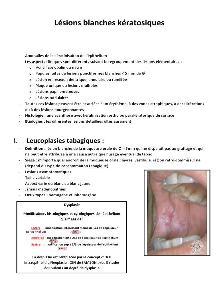 Lésions Kératosiques de la Muqueuse Orale | PDF | Candidose | Maladies ...