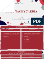 Sinus Tachycardia